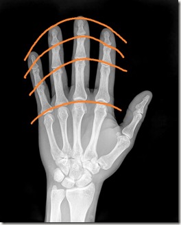 courbe phalanges