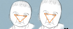comparaison portrait de bébé avec nez incorrect